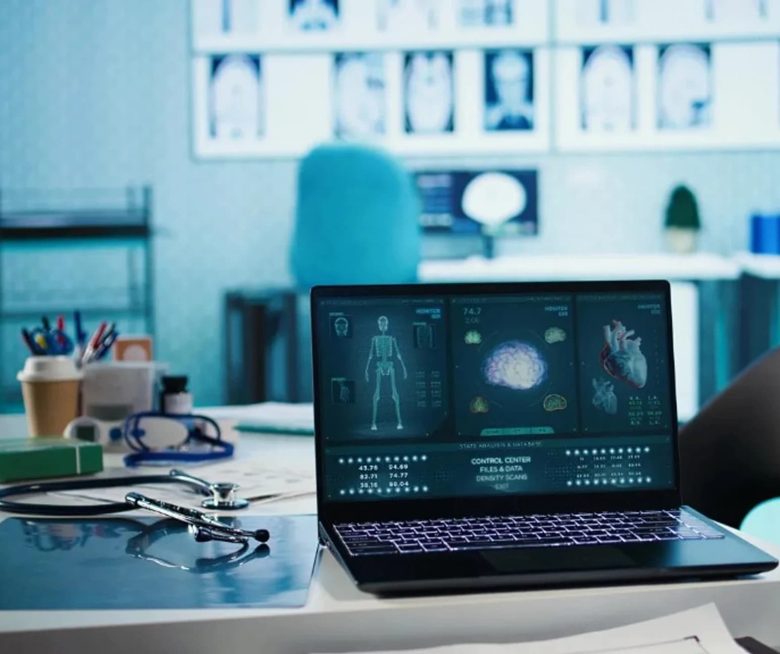 Medical laptop displaying clinical imaging dashboards in a modern healthcare workspace with stethoscope and scan data